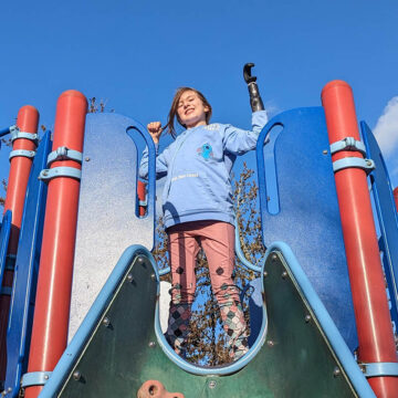 prosthetics_pediatrics_upperlimb-sm prosthetics_pediatrics_upperlimb-sm